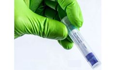 BioScreener - Bio-Weapons Agents Screening Kit