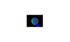 CellSieve - Microfiltration for Circulating Tumor Cells