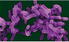 Using Hazard Analysis and Critical Control Point Water Management Plans to Prevent Legionellosis