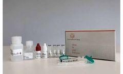 Aflatoxin - Total Rapid FRTest Kit
