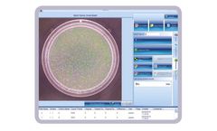 Synbiosis - Ames Plate Counting Softwares