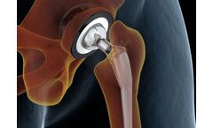 Monitors and Analysers for Industrial Processing - Medical Devices