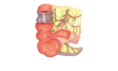 Wildco - Model 2X Mag. 644-6800 - Appendix and Caecum Relief Model