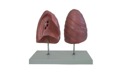 Wildco - Model 644-5200 - Left and Right Natural Size Lung Model