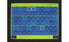 BacT/ALERT - Model 3D - Healthcare