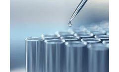 Legionella Bacteria Water Sampling Methodology