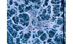 Yorkshire Water uses Bioflo+ filter media in £8 Million upgrade to Malton WWTW