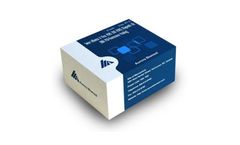 Aurora Biomed - High Throughput DNA Extraction Kits and RNA Extraction Kits