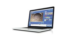 Trio-Vision - Version AssetDMS - Pipe Survey Data Collection Software