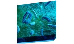 Legionellosis: Breaking the chain of Infection
