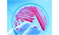 Microbial Biosensors for Microorganism  Detection