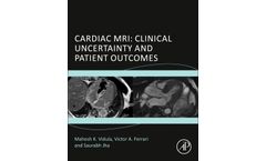 Cardiac MRI