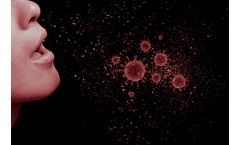 10 scientific reasons why SARS-CoV-2 is airborne