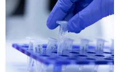 CARBIOS - Recycling and Biodegradation Processes System