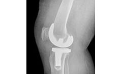 Independent particle characterization services for medical devices industries