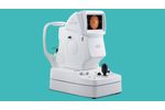 Kowa Nonmyd AF - Non-Mydriatic Retinal Camera - Video