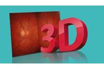 Kowa Nonmyd WX-3D Simultaneous Stereoscopic Retinal Camera - Video