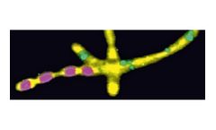 Nano-analytical microscope systems solutions for Life science sector
