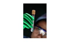 TSS - Water Monitoring Services