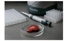 Studying Polycystic Kidney Disease by ATAC-seq Relies on Well-Controlled Nuclei Preparation