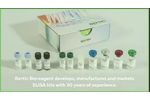  Do you know the advantages of AChE in ELISA reading? 