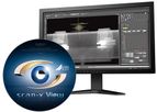 DÜRR - Version ScanX View PT - Basic Software Suite
