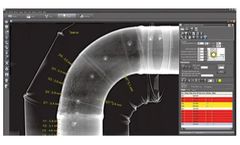 DÜRR - Version ScanX View - Special Measurement Tool