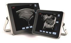 ExaPad and ExaPad mini - Veterinary Ultrasound Scanners