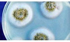 Microbiology Laboratory Services