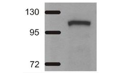 Agrisera - Model ADH/ALDH - Alcohol/Acetaldehyde Dehydrogenase, Bacterial/Algal