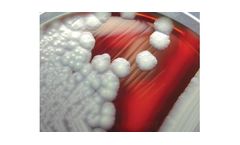 Bacterial Analysis