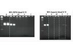 SureDirect Blood PCR Kit