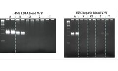 SureDirect Blood PCR Kit