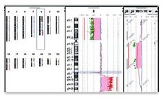Microarray Data Analysis Service