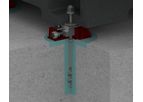 Unisorb - Model RK - Fixator System
