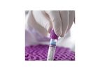 ALFA21 - Advanced System for the Management of Clinical Analysis Software