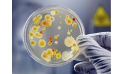 Considerations regarding the use of bacteria in aquaculture for bioremediation/bioaugmentation