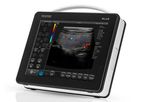 Draminski - Blue Portable Ultrasound Scanner