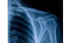 Silver Recovery & Recycling X-Rays