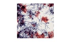 Kemira FilamentEx - Bulking Sludge And Foam Control