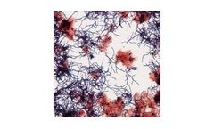 Kemira FilamentEx - Improving Biological Treatment