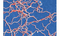 Native - Borrelia Afzelii Antigen