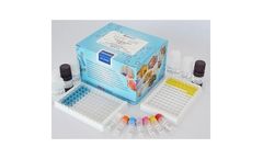 Aflatoxin B1 ELISA Test Service