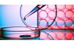Abzymes Research is a New Field of Enzyme Engineering