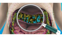 Human Intestinal Ecosystem Analysis