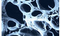 CONTARBON - Activated Carbon