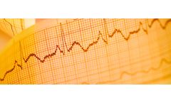 4cRisk - Manual Handling Services