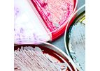 Antigen Characterization Services for Autogenous Cattle Vaccine