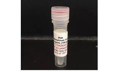 ANP - Biothreat Agents Antibody