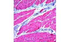 Model 1A4 - Alpha-Smooth Muscle